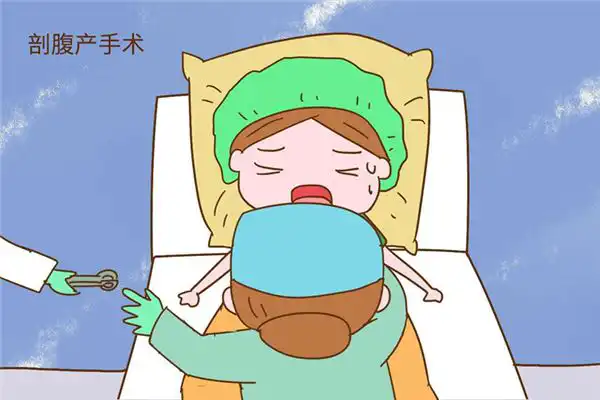 剖腹產有必要選日子嗎